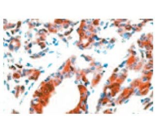 VEGF Antibody (JH121) - Immunohistochemistry - Image 67406 