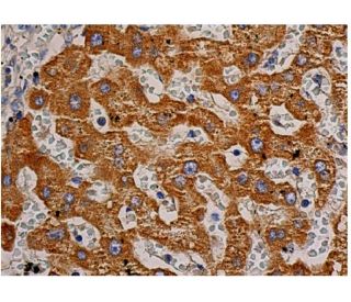 VEGF Antibody (VG-1) - Immunohistochemistry - Image 348041 