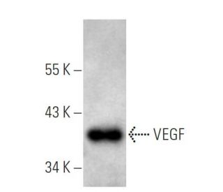 VEGF Antibody (VG76e) - Western Blotting - Image 12695