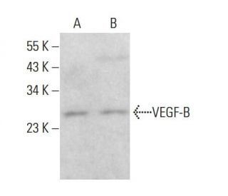 VEGF-B Antibody (56-1) - Western Blotting - Image 381326