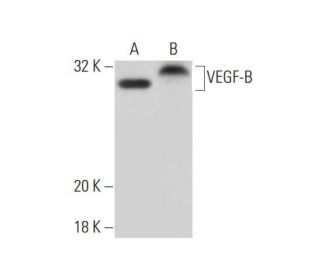 VEGF-B Antibody (MM0008-7B43) - Western Blotting - Image 137605