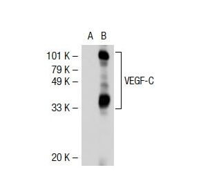 VEGF-C Antibody (F-10) - Western Blotting - Image 38846 