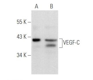 VEGF-C Antibody (F-5) - Western Blotting - Image 357420 