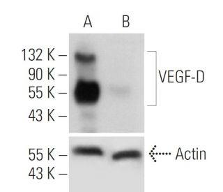 VEGF-D shRNA Plasmid (h): sc-39844-SH. Western blot analysis of human VEGF-D expression in VEGF-D transfected (A) and VEGF 