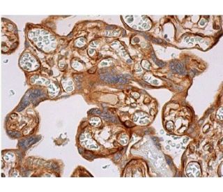 Flk-1/KDR/VEGFR2 Antibody (D-8) - Immunohistochemistry - Image 353882 