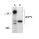 Flk-1/KDR/VEGFR2 Antibody (F-10) - Western Blotting - Image 304381 