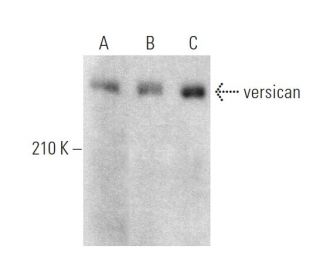 versican Antibody (4C5) - Western Blotting - Image 375058The Double Nickase Plasmid features a U6 promoter for sgRNA expression, a 20 nt targeting sequence, and a gRNA scaffold to guide Cas9n. It includes a CBh promoter for Cas9n (D10A) and puromycin resistance, GFP for transfection verification, and nuclear localization signals (NLS). The 2A peptide allows co-expression of Cas9n and Puro from a single promoter, enabling precise genome editing with reduced off-target effects.