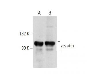 vezatin Antibody (B-1) - Western Blotting - Image 137633 
