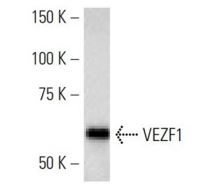 VEZF1 Antibody (ZNF5J141) - Western Blotting - Image 16844 