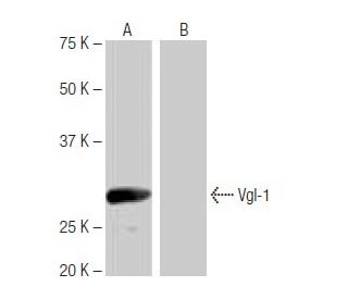 Vgl-1 Antibody (NQ-A1) - Western Blotting - Image 65094