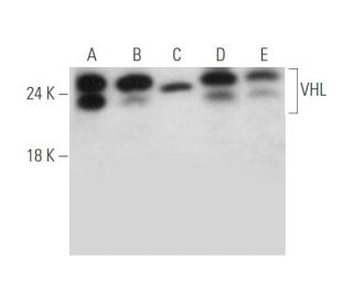 Von Hippel Lindau/VHL Antibody (B-9) - Western Blotting - Image 333638