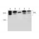 Von Hippel Lindau/VHL Antibody (B-9) - Western Blotting - Image 333638