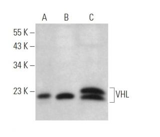 Von Hippel Lindau/VHL Antibody (D-11) - Western Blotting - Image 374894 