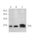 Von Hippel Lindau/VHL Antibody (D-11) - Western Blotting - Image 374894 