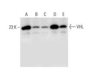 Von Hippel Lindau/VHL Antibody (G-3) - Western Blotting - Image 314087 
