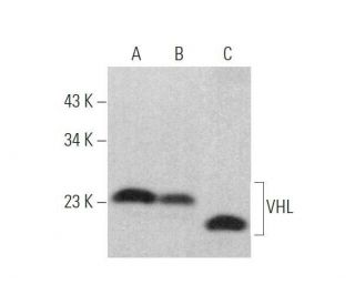 Von Hippel Lindau/VHL Antibody (G-7) - Western Blotting - Image 353351 