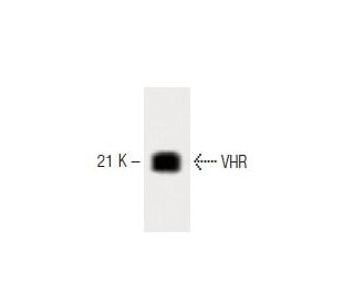 VHR Antibody (24) - Western Blotting - Image 60491 