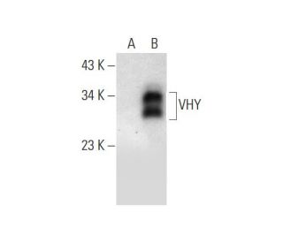 VHY Antibody (F-11) - Western Blotting - Image 299068