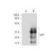 VHY Antibody (G-7) - Western Blotting - Image 68418