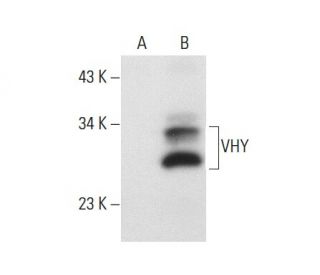 VHY Antibody (G-7) - Western Blotting - Image 72321 
