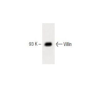 Villin Antibody (12) - Western Blotting - Image 60492 