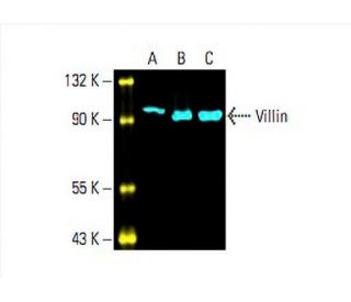 Villin Antibody (1D2C3) - Western Blotting - Image 393168 