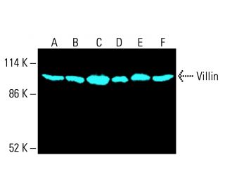 Villin Antibody (1D2C3) - Western Blotting - Image 416408 