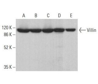 Villin Antibody (BDID2C3) - Western Blotting - Image 378514 