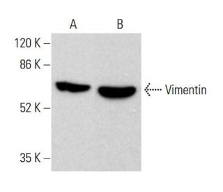 Vimentin Antibody (3CB2) - Western Blotting - Image 376612 