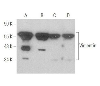 Vimentin Antibody (5G3F10) - Western Blotting - Image 349971 