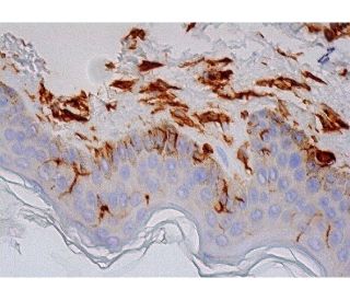 Vimentin Antibody (9E7E7) - Immunohistochemistry - Image 293460 