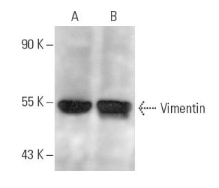 Vimentin Antibody (J144) - Western Blotting - Image 14610