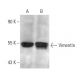 Vimentin Antibody (J144) - Western Blotting - Image 14610