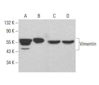 Vimentin Antibody (RV202) - Western Blotting - Image 383737 