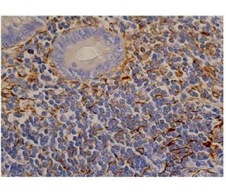 Vimentin Antibody (RV203) - Immunohistochemistry - Image 348277 