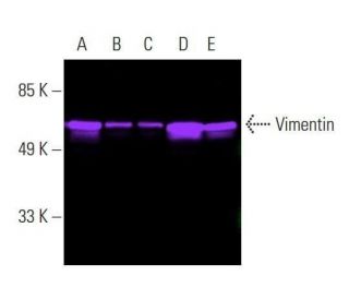 Vimentin Antibody (V9) - Western Blotting - Image 390382 