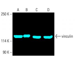 vinculin Antibody (7F9) - Western Blotting - Image 401973
