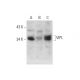 VIPL Antibody (A-4) - Western Blotting - Image 333425