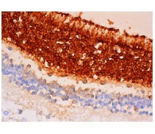 Visual Arrestin Antibody (G-2) - Immunohistochemistry - Image 346398 