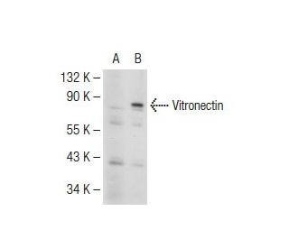 Vitronectin 75 Antibody (GMA-900) - Western Blotting - Image 109487