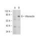 Vitronectin 75 Antibody (GMA-900) - Western Blotting - Image 109487