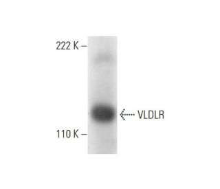 VLDLR Antibody (E-8) - Western Blotting - Image 295942 