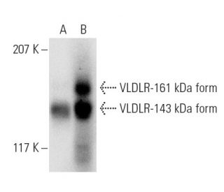 VLDLR Antibody (6A6) - Western Blotting - Image 2909 