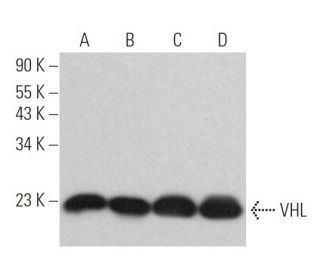 Von Hippel Lindau/VHL Antibody (VHL40) - Western Blotting - Image 361696 