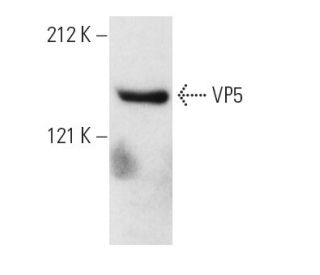 VP5 Antibody (6F10) - Western Blotting - Image 5619