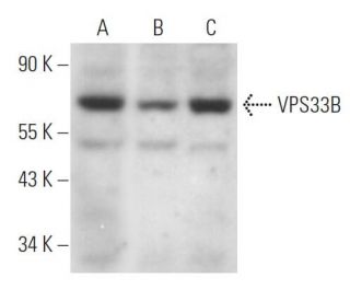 VPS33B Antibody (G-9) - Western Blotting - Image 367235Each CRISPR/Cas9 Knockout (KO) Plasmid product consists of a pool of 3 plasmids designed to ensure identification and cleavage of a specific gene for maximum knockout efficiency. Each plasmid encodes a unique 20 nt sequence derived from the GeCKO (v2) library.
