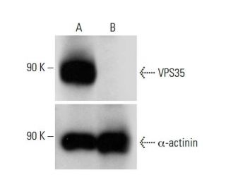 VPS35 HDR Plasmid (h): sc-402019-HDR. Western blot analysis of VPS35 expression in non-transfected control(A) and puromyciEach CRISPR/Cas9 Knockout (KO) Plasmid product consists of a pool of 3 plasmids designed to ensure identification and cleavage of a specific gene for maximum knockout efficiency. Each plasmid encodes a unique 20 nt sequence derived from the GeCKO (v2) library.