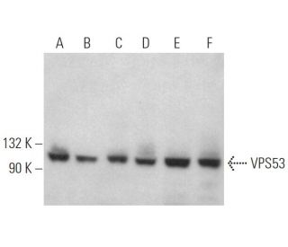 VPS53 Antibody (H-4) - Western Blotting - Image 373253 