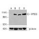 VPS53 Antibody (H-4) - Western Blotting - Image 415722