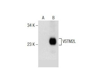 VSTM2L Antibody (A-4) - Western Blotting - Image 155839SAM Transcription Activation: SAM system utilizing dCas9-VP64, MS2-P65-HSF1, and sgRNA for precise gene transcription activation.